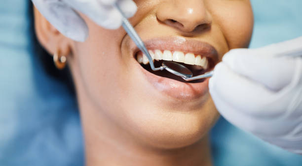 Best Emergency Wisdom Teeth Removal in Magnolia, AR